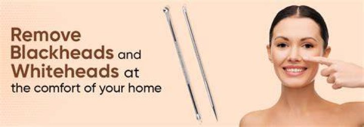 blackhead and whitehead removal