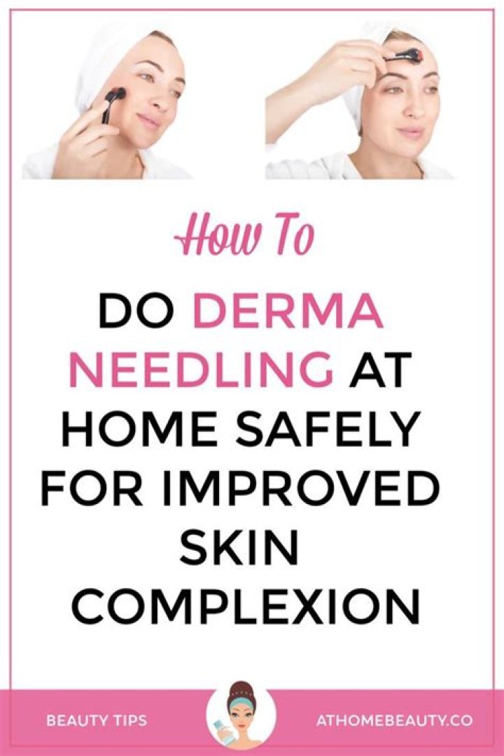 Derma needling - How To Discuss