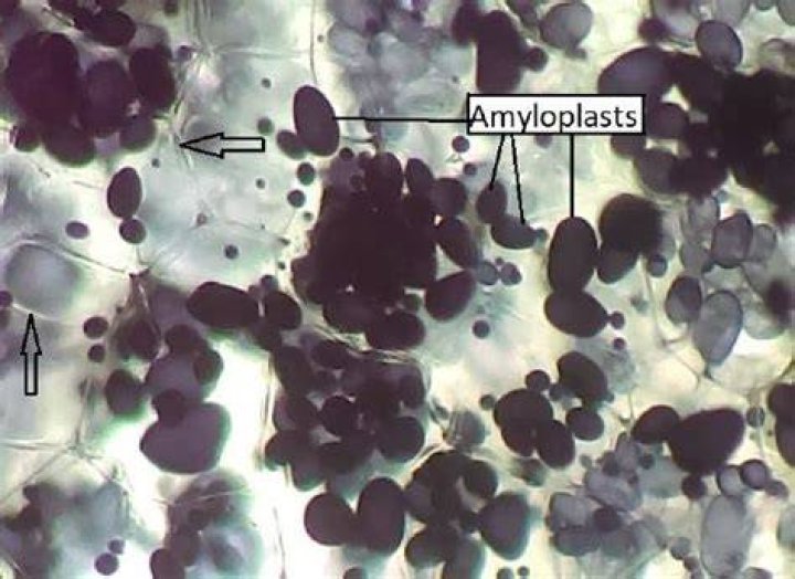 Do potato cells have amyloplasts?