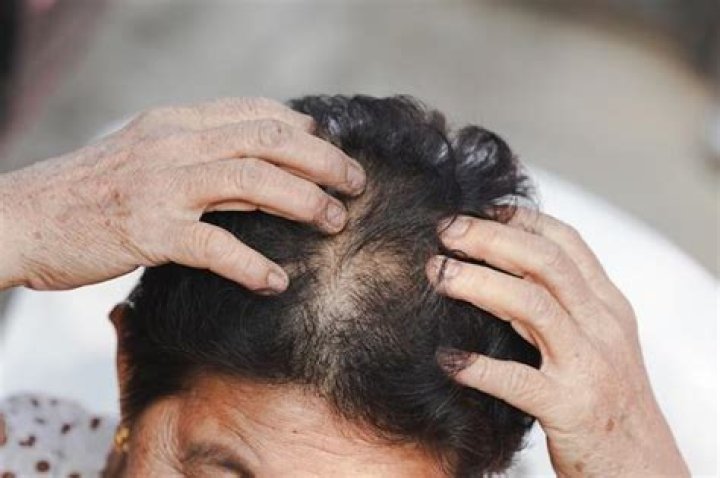 Does scalp itch when new hair grows