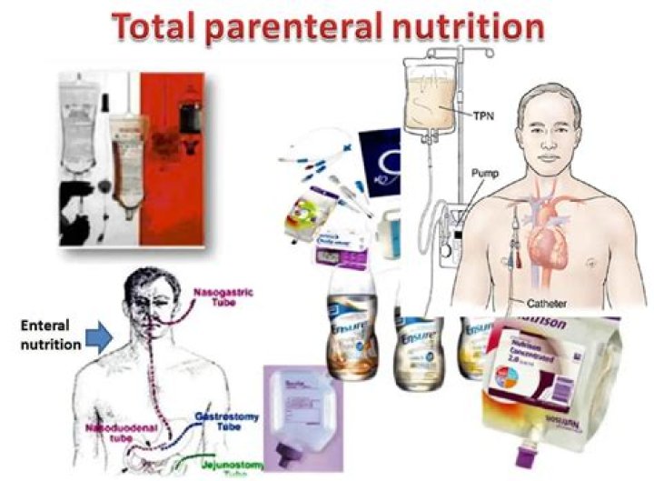 How can parenteral products be administered