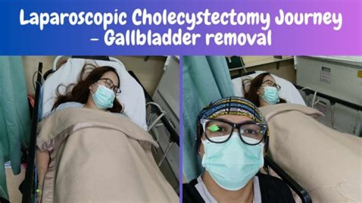 Lathroscopic - How To Discuss