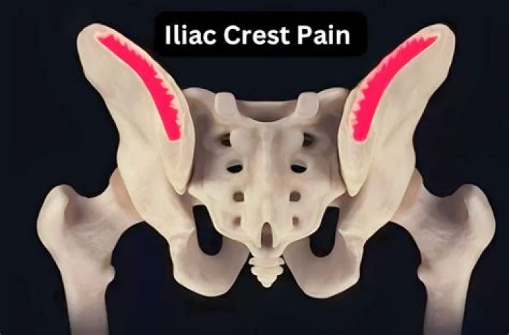 What does left iliac fossa pain indicate