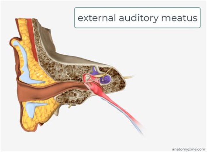 What is a CT internal auditory meatus both