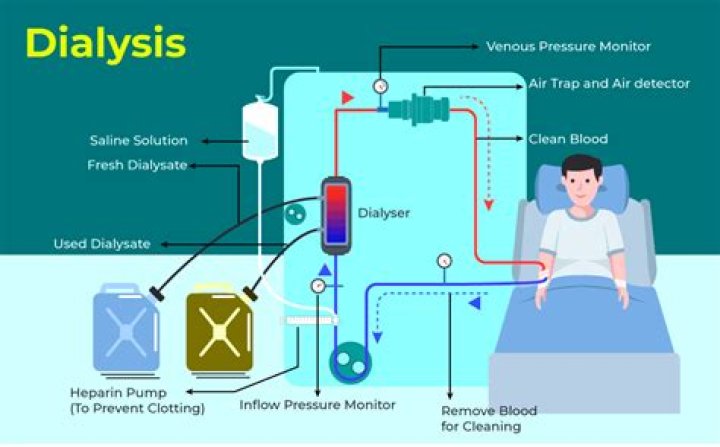 What is dialysis used for